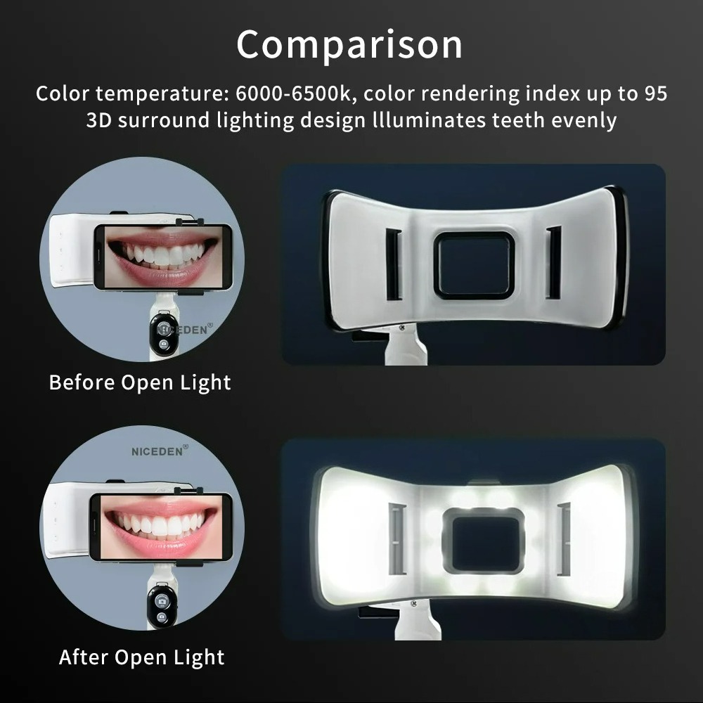 Luz de Fotografia Odontológica - Photography Dental avaliação e preço