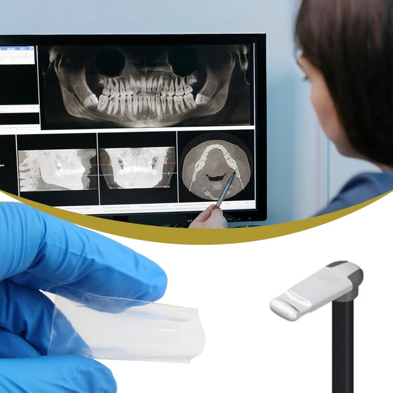 200 Peças/caixa Capas Protetor - Photography Dental avaliação e preço
