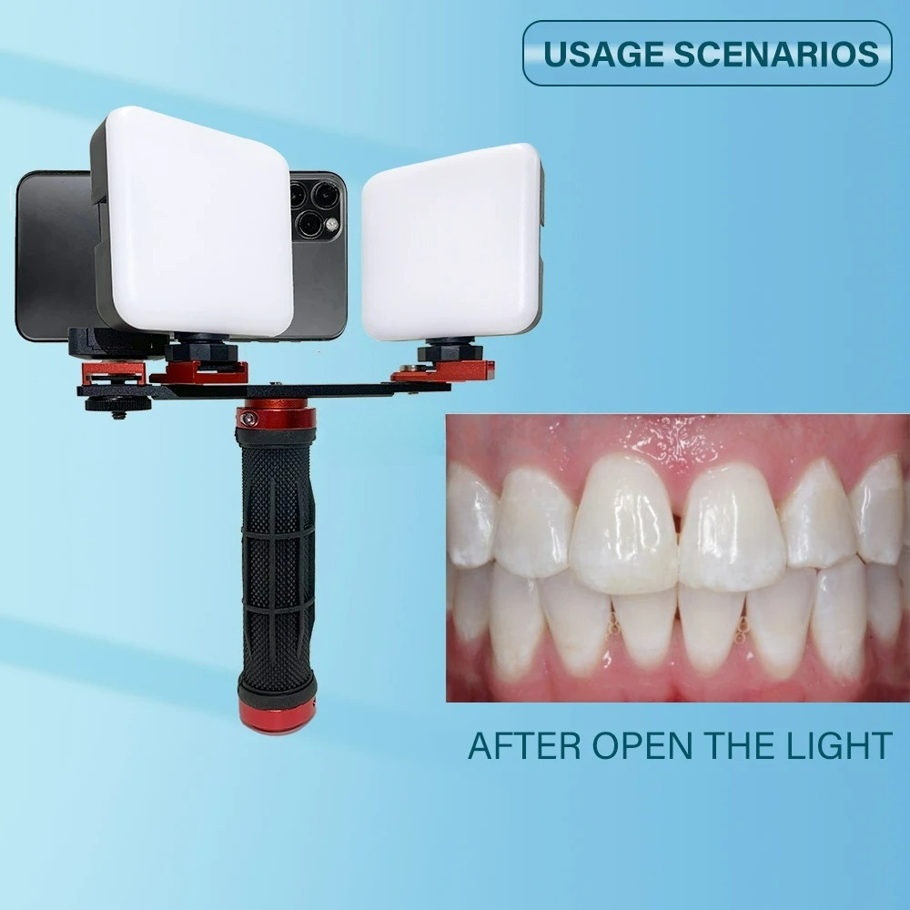 Luz de Fotografia Odontológica - Photography Dental avaliação e preço