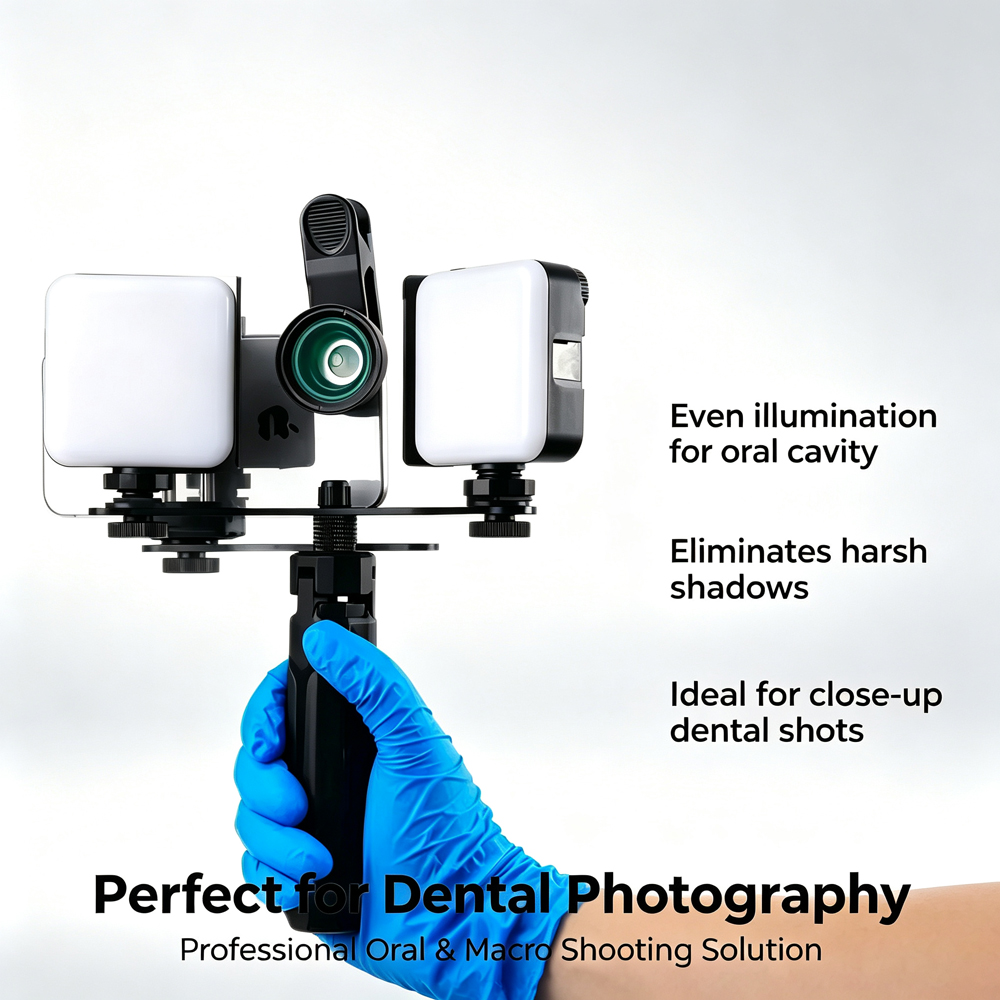 LODDEN-LED Luz de preenchiment - Photography Dental avaliação e preço