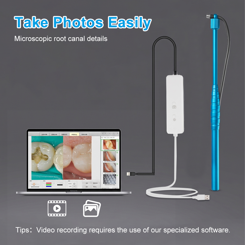 Câmera intraoral micro de 5MP, - Photography Dental avaliação e preço