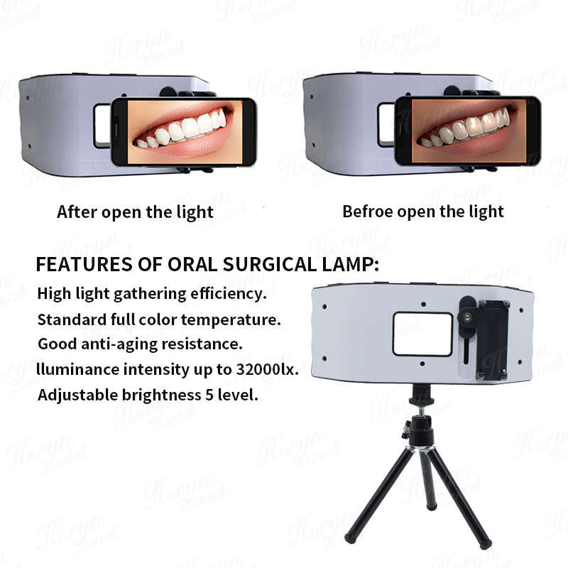 Luz de flash dental equipament - Photography Dental avaliação e preço